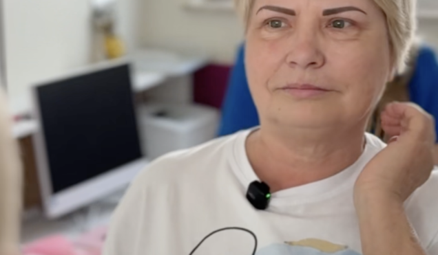 Pacjentka Dobry Wzrok po plastyce powiek górnych — metamorfoza Pani Łucji, dr Paulina Rydecka-Koerber